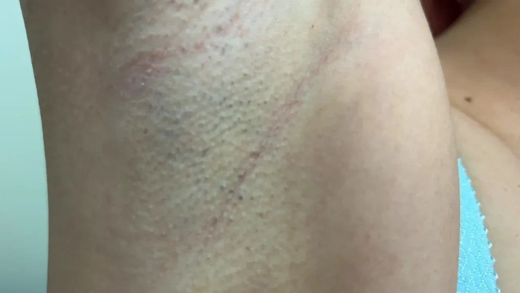 安堂はるのジョリ腋