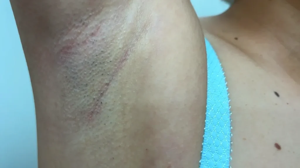 安堂はるのジョリ腋