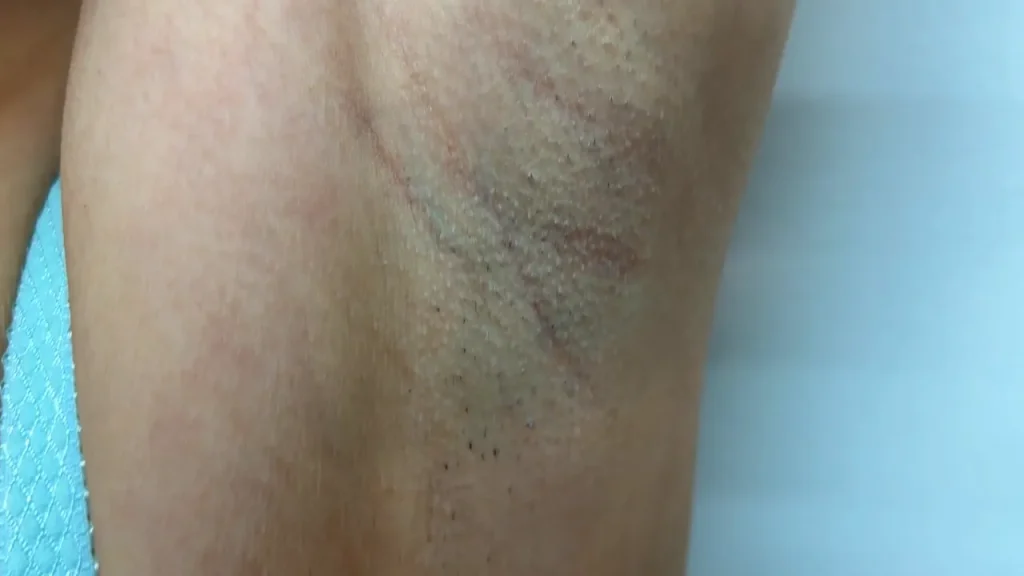 安堂はるのジョリ腋