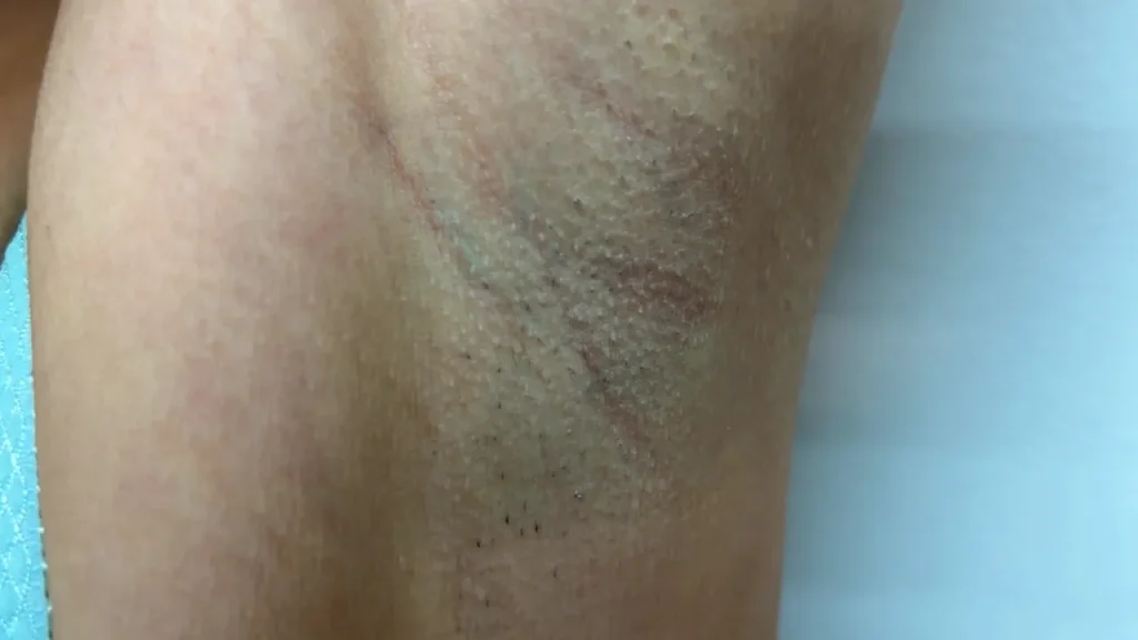 安堂はるのジョリ腋